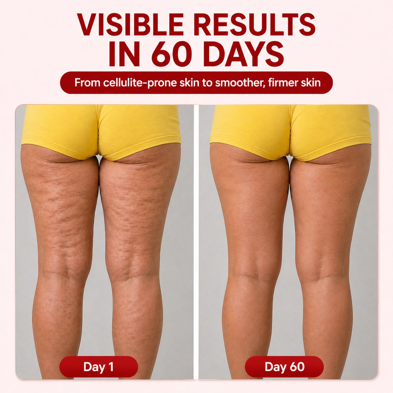 Red Light Therapy Massager for Cellulite Reduction