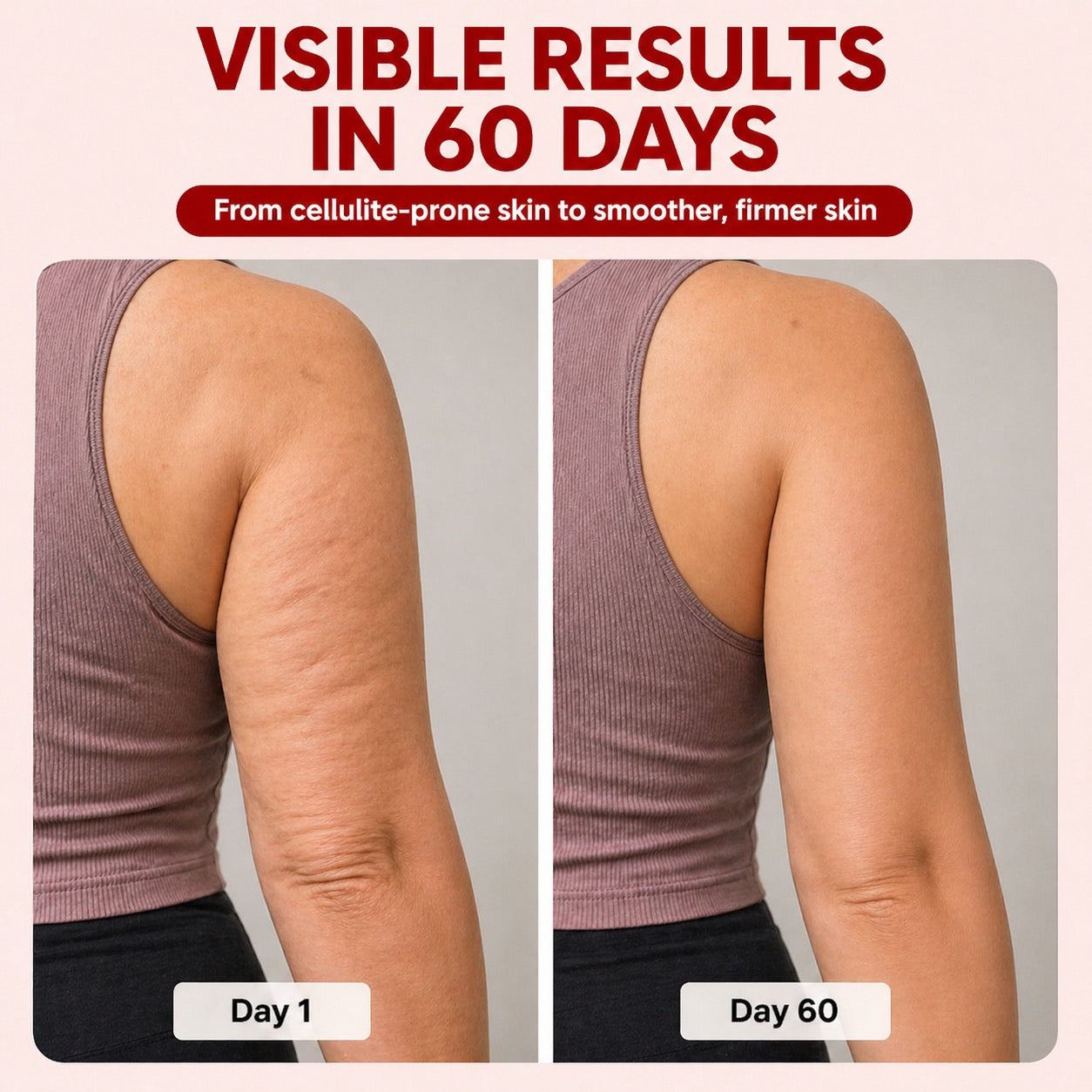 Red Light Therapy Massager for Cellulite Reduction
